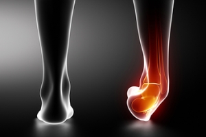 Why Does My Ankle Feel Unstable?