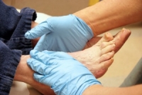 The Relationship Between Diabetes and Itchy Feet